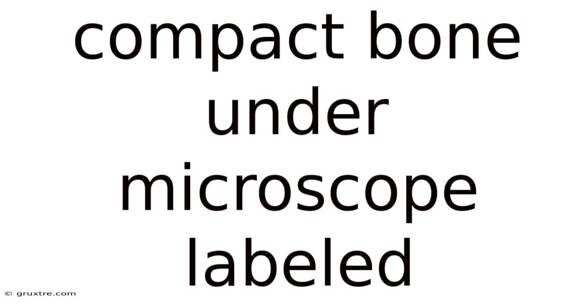 Compact Bone Under Microscope Labeled