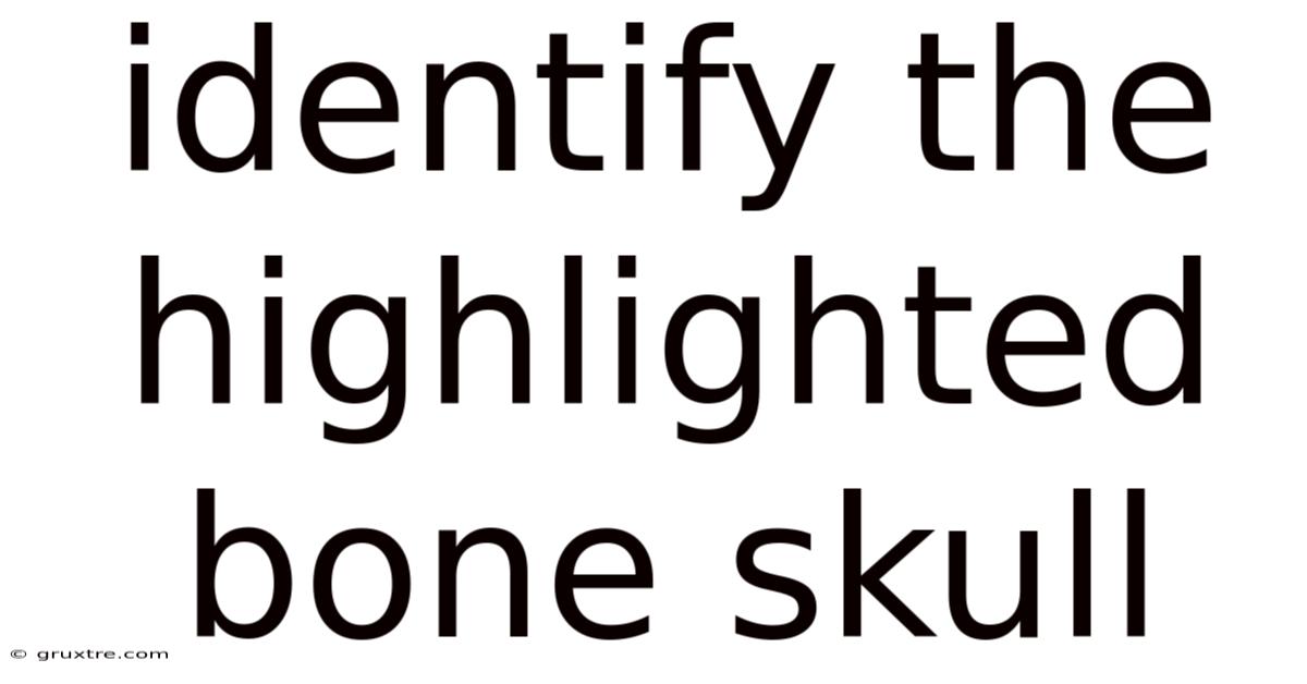 Identify The Highlighted Bone Skull