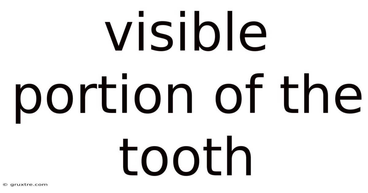 Visible Portion Of The Tooth